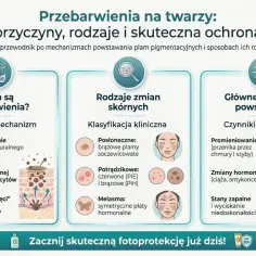 Przewodnik po przebarwieniach na twarzy: przyczyny, rodzaje i ochrona. Dowiedz się o nagromadzeniu melaniny, zmianach hormonalnych i skutkach UV.