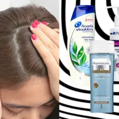 Widoczny łupież na włosach. Obok szampony Head & Shoulders, Pirolam i Pharmaceris, które pomagają zwalczyć problem.