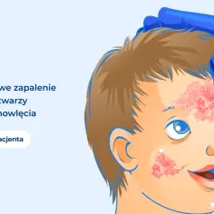 Dziecko z atopowym zapaleniem skóry na twarzy. Skóra jest zaczerwieniona i sucha, szczególnie na czole i policzkach.