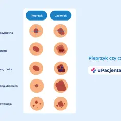 Porównanie pieprzyka i czerniaka: asymetria, brzegi, kolor, średnica i ewolucja.