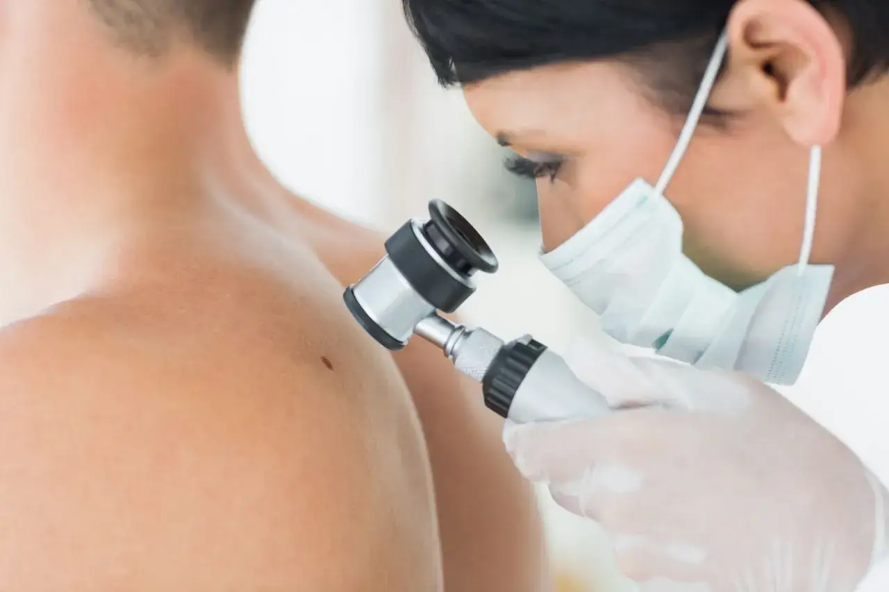 Dermatolog bada pieprzyki na skórze pacjenta za pomocą dermatoskopu.