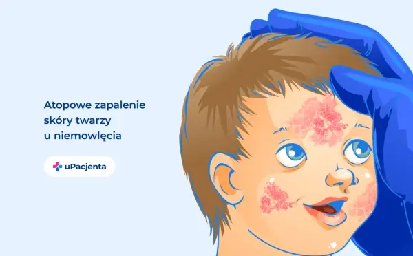 AZS na twarzy - Jak rozpoznać i skutecznie pielęgnować?